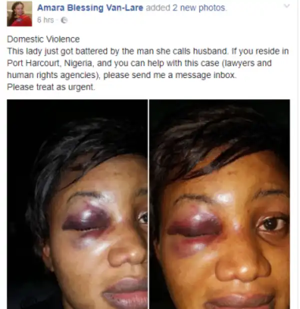 See What A Man Did To His Wife In Port Harcourt (Disturbing Photos)